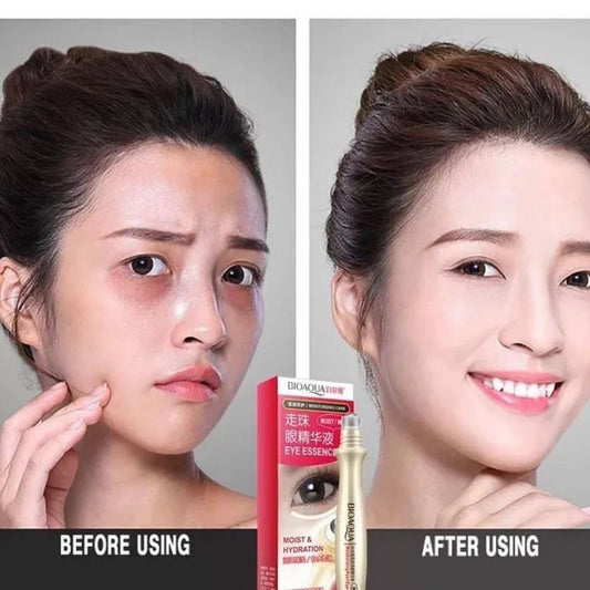 Dark Circles Eye Gel Serum Roller- Original