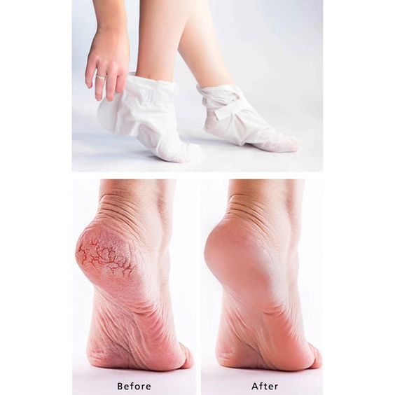 Moisturizing Foot mask